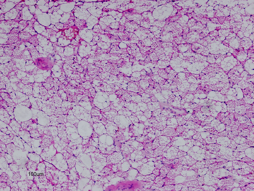 microscopic image of human adipose tissue microscopic image of human adipose tissue