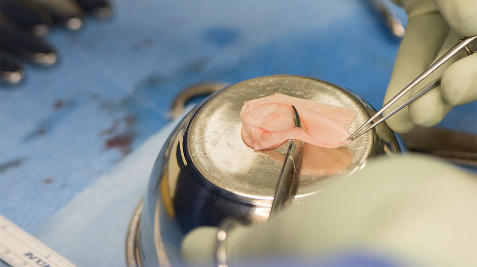 In the operating theatre, the graft is tailored to the shape and size of the cartilage defect in the knee. (Image: University of Basel, Christian Flierl) In the operating theatre, the graft is tailored to the shape and size of the cartilage defect in the knee. (Image: University of Basel, Christian Flierl)