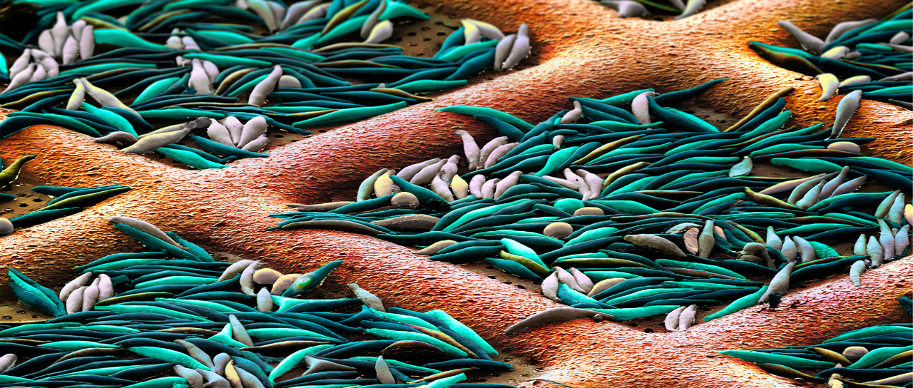 Diatoms frozen on an electron microscopy grid (copper)