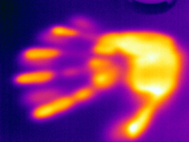 Living organisms radiate heat: image of a human hand taken with a thermal imaging camera. (Image: University of Basel, Department of Biomedical Engineering) Living organisms radiate heat: image of a human hand taken with a thermal imaging camera. (Image: University of Basel, Department of Biomedical Engineering)