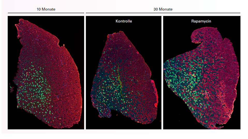Cross sections of a lower leg muscle (tibialis anterior) from healthy, ten-month-old mice (left), from 30-month-old mice that received a low dose of rapamycin in their food (right), and from a control group of the same age (center). Rapamycin delays the onset of muscle atrophy in the older mice, preserving muscle size and increases the number of oxidative (in green and black) and glycolytic (in red) muscle fibers. (Photo: University of Basel, Biozentrum, Daniel J. Ham & Markus A. Rüegg). Cross sections of a lower leg muscle (tibialis anterior) from healthy, ten-month-old mice (left), from 30-month-old mice that received a low dose of rapamycin in their food (right), and from a control group of the same age (center). Rapamycin delays the onset of muscle atrophy in the older mice, preserving muscle size and increases the number of oxidative (in green and black) and glycolytic (in red) muscle fibers. (Photo: University of Basel, Biozentrum, Daniel J. Ham & Markus A. Rüegg).
