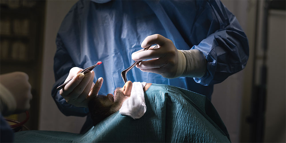 A surgeon in blue surgical clothing, gloves, a face mask and magnifying glasses performs an operation. The patient is lying on an operating table, covered with a surgical drape, with his mouth open. The surgeon is holding a pair of tweezers with a piece of tissue that he has removed from the nose. A surgeon in blue surgical clothing, gloves, a face mask and magnifying glasses performs an operation. The patient is lying on an operating table, covered with a surgical drape, with his mouth open. The surgeon is holding a pair of tweezers with a piece of tissue that he has removed from the nose.